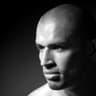 Scalp Pigmentation Ireland